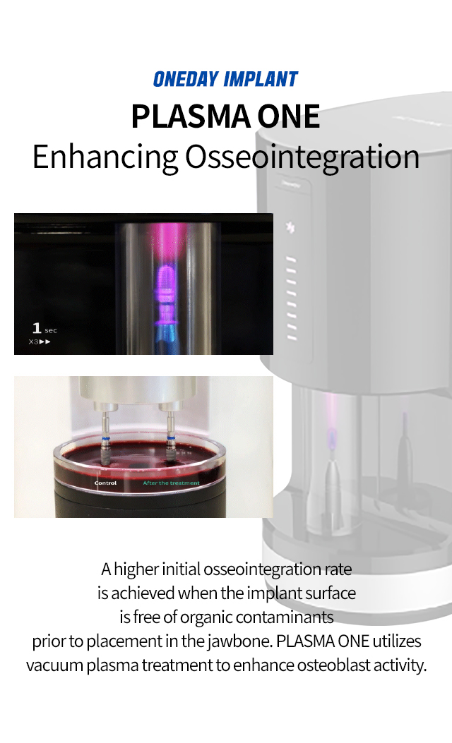 PLASMA ONE surface treatment concept for osseointegration.